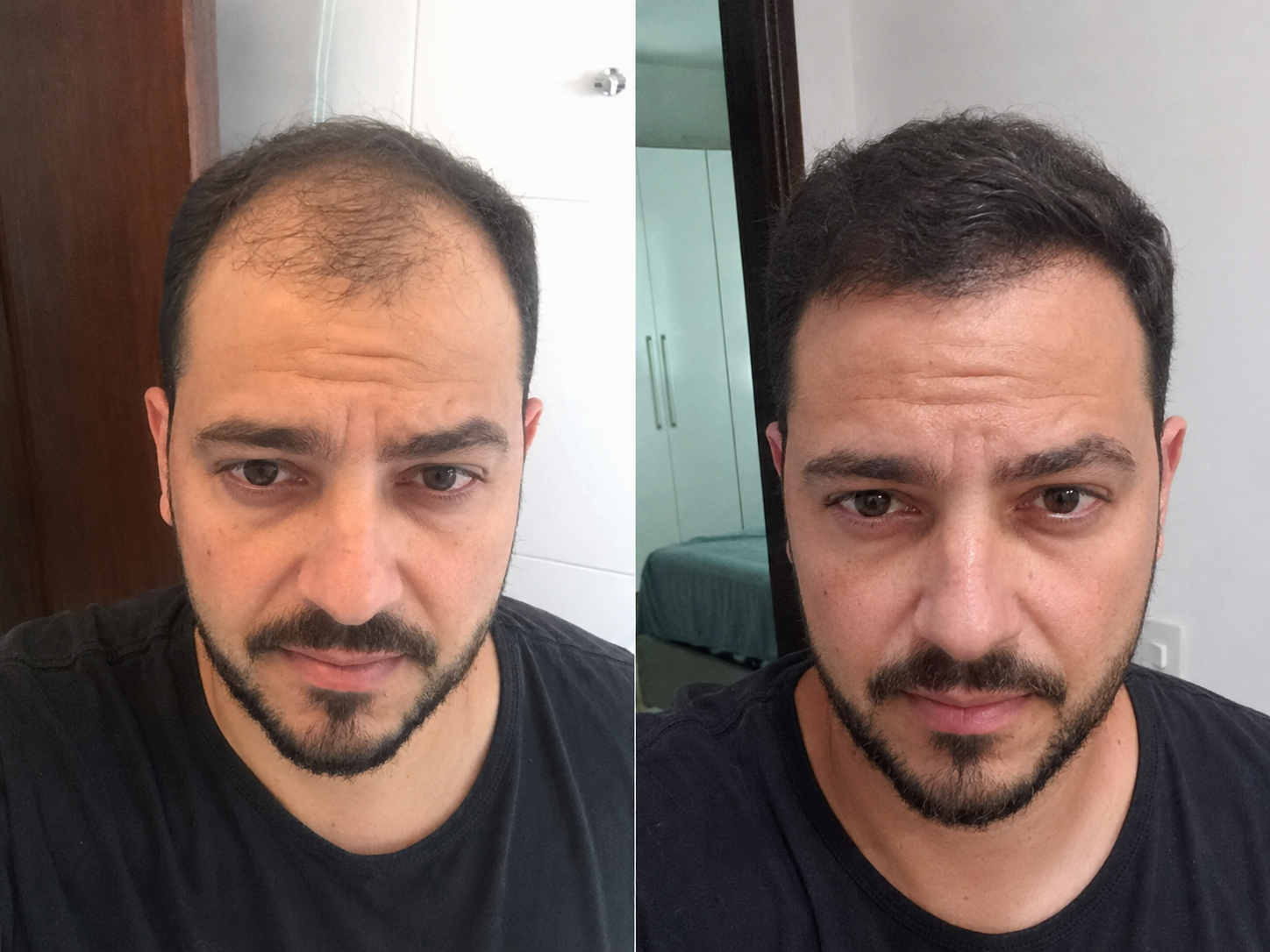Resultado 1