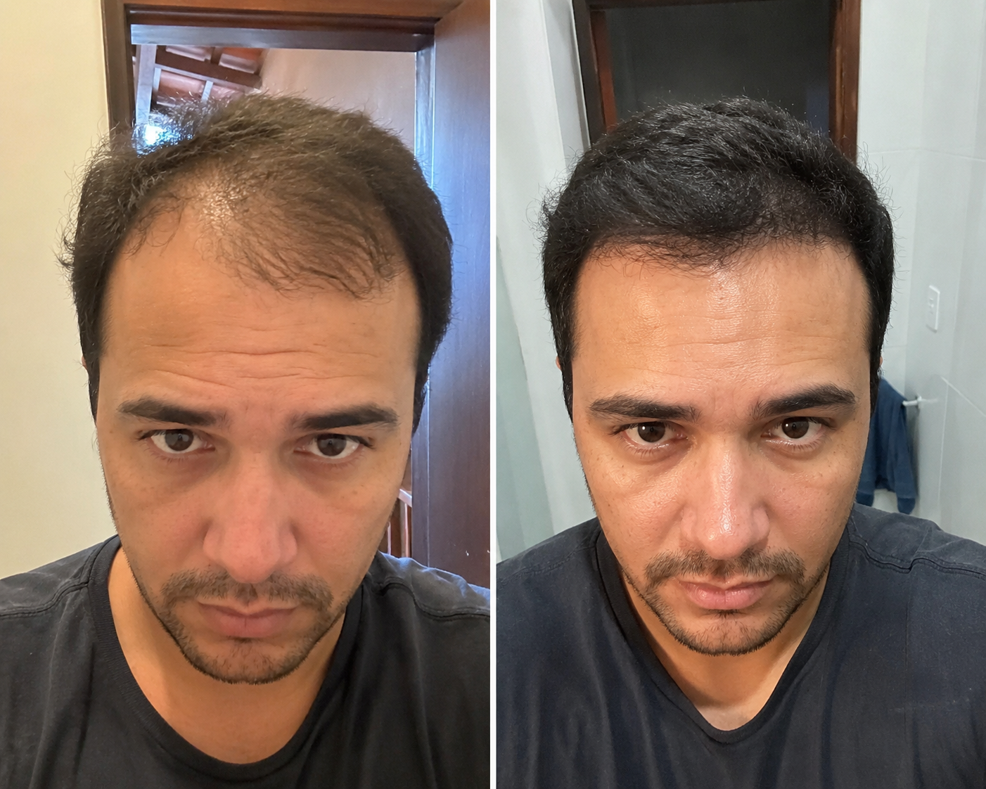 Resultado 2