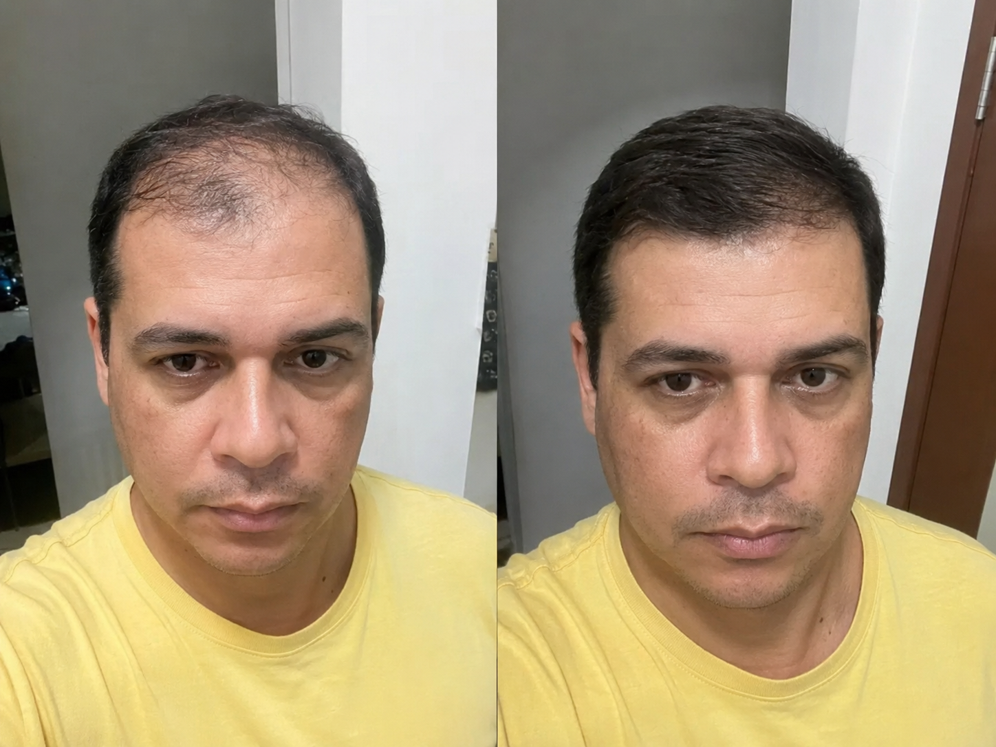 Resultado 3