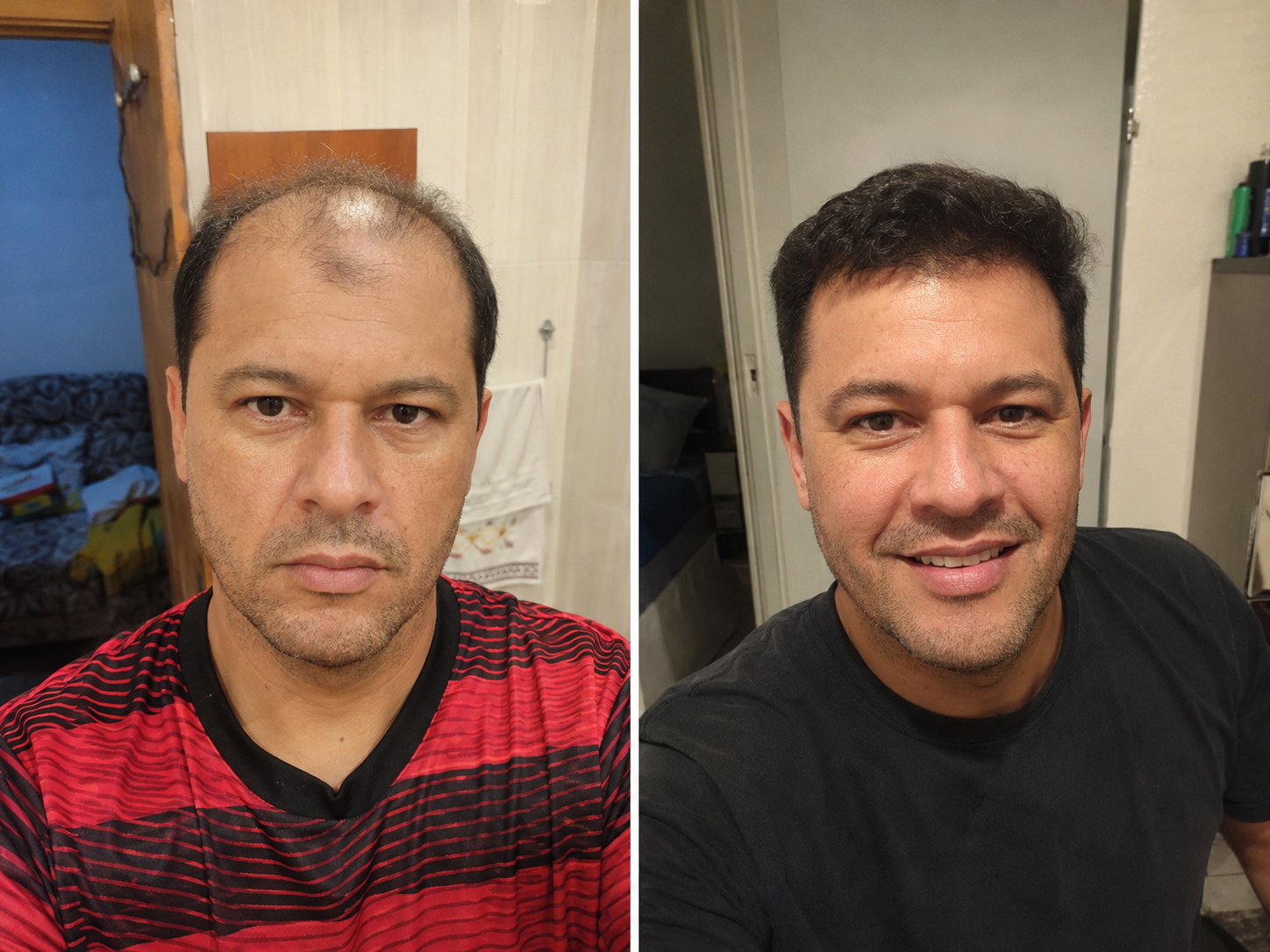 Resultado 4
